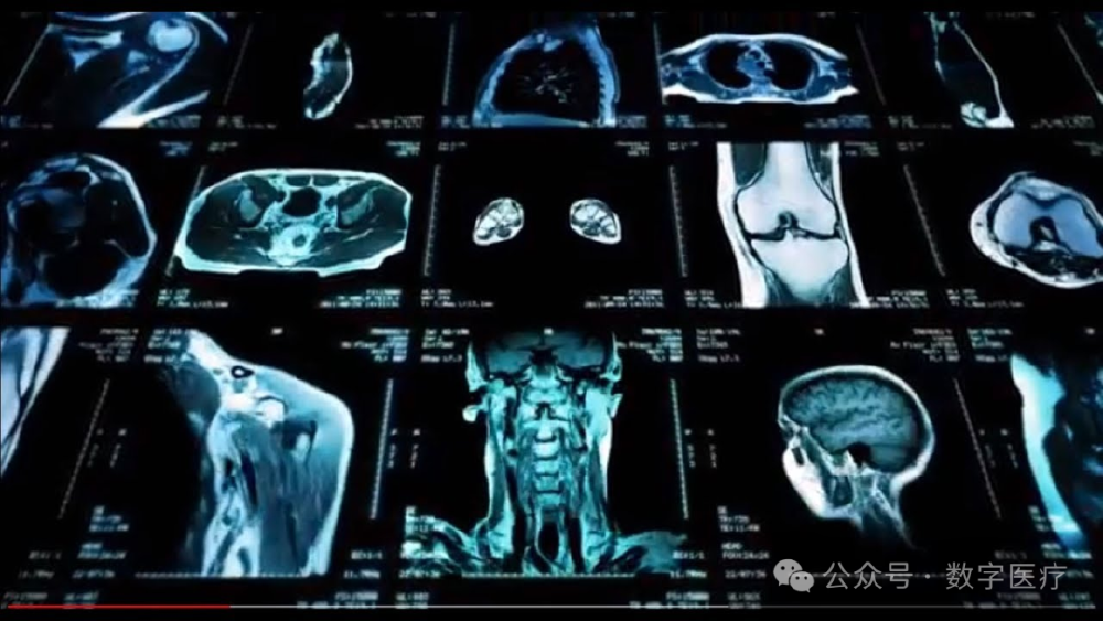 多模态模型医疗影像分析示例
